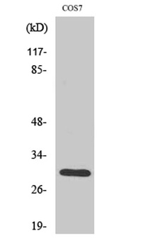HCCS rabbit pAb Antibody