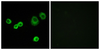 HCCS rabbit pAb Antibody