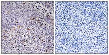 HCCS rabbit pAb Antibody