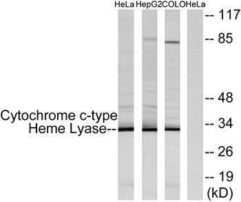 HCCS rabbit pAb Antibody