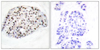 HDAC1 rabbit pAb Antibody