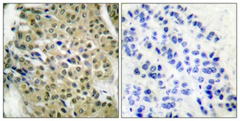 HDAC5/9 rabbit pAb Antibody