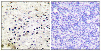 HDAC5/9 rabbit pAb Antibody