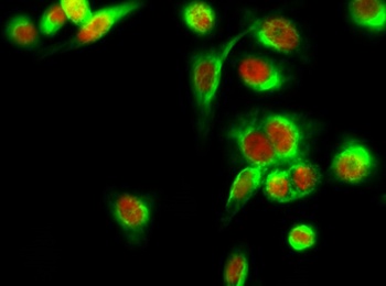 HDAC6 rabbit pAb Antibody