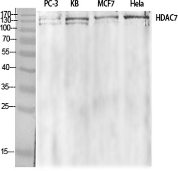 HDAC7 rabbit pAb Antibody