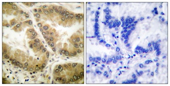 Histone deacetylase 7a rabbit pAb Antibody