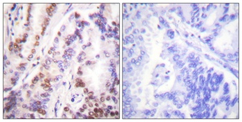 Histone deacetylase 9 rabbit pAb Antibody
