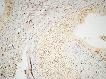 hnRNP A2/B1 rabbit pAb Antibody