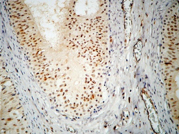 hnRNP A2/B1 rabbit pAb Antibody