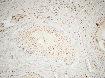 hnRNP A2/B1 rabbit pAb Antibody