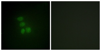 hnRNP G rabbit pAb Antibody