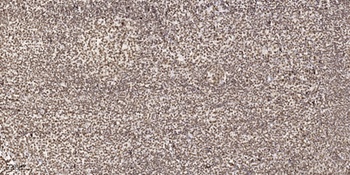 hnRNP G rabbit pAb Antibody
