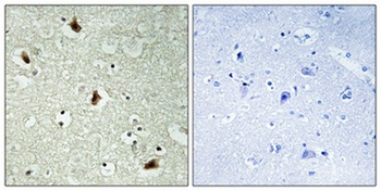 hnRNP K rabbit pAb Antibody