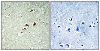 hnRNP K rabbit pAb Antibody