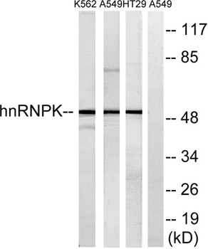 hnRNP K rabbit pAb Antibody