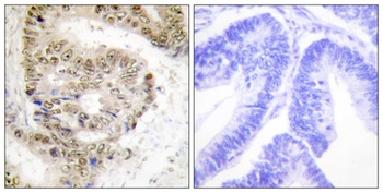 hnRNP L rabbit pAb Antibody