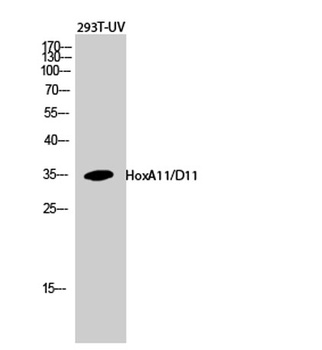 HoxA11/D11 rabbit pAb Antibody