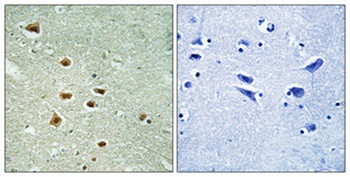 HoxA11/D11 rabbit pAb Antibody