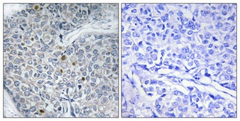 HoxD12 rabbit pAb Antibody