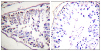 HSL rabbit pAb Antibody