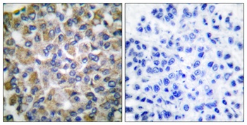 HSP A9 rabbit pAb Antibody