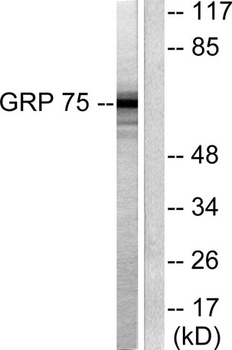 HSP A9 rabbit pAb Antibody