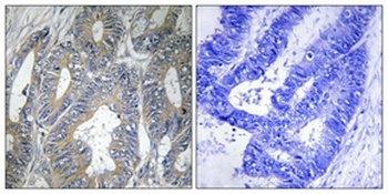 HSP β2 rabbit pAb Antibody