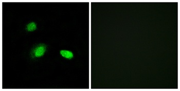 HSP β2 rabbit pAb Antibody