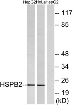 HSP β2 rabbit pAb Antibody