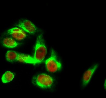 HSP40 rabbit pAb Antibody