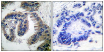 HSP40 rabbit pAb Antibody