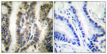 HSP60 rabbit pAb Antibody