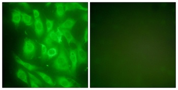 HSP90A rabbit pAb Antibody