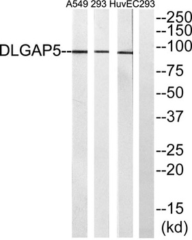 HURP rabbit pAb Antibody
