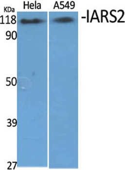 IARS2 rabbit pAb Antibody