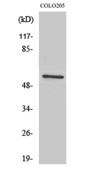 Ikaros 3 rabbit pAb Antibody