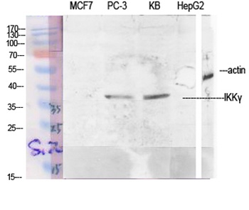 IKKγ rabbit pAb Antibody