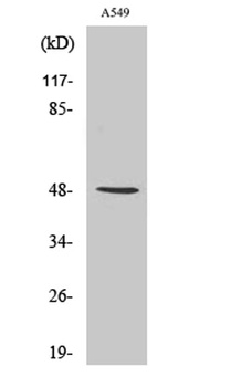 IKKγ rabbit pAb Antibody