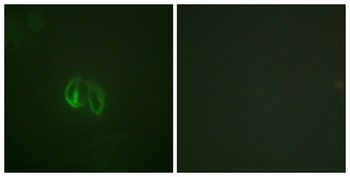 IL-10Rα rabbit pAb Antibody