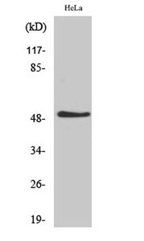 IL-11Rα rabbit pAb Antibody