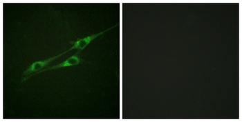IL-13Rα1 rabbit pAb Antibody
