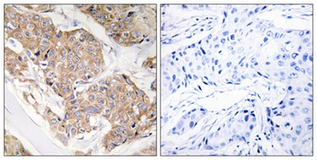 IL-13Rα1 rabbit pAb Antibody