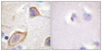 IL-3Rβ rabbit pAb Antibody