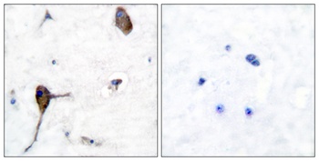 IL-3Rβ rabbit pAb Antibody