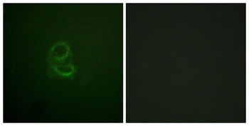 IL-4Rα Rabbit Polyclonal Antibody