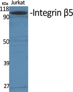 Integrin β5 rabbit pAb Antibody