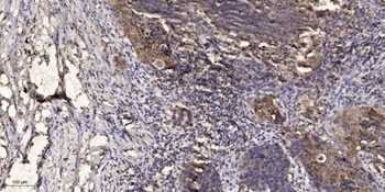 IRAK-1 rabbit pAb Antibody