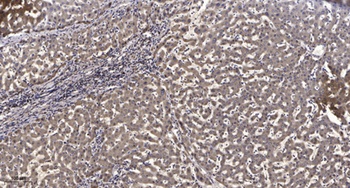 IRAK-2 rabbit pAb Antibody