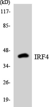 IRF-4 rabbit pAb Antibody