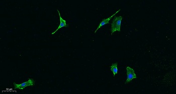 JAK1 rabbit pAb Antibody